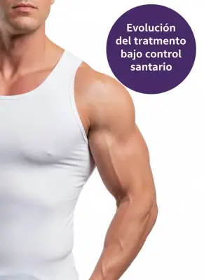 Brazo masculino como referencia al tratamiento de depilación láser de brazos.