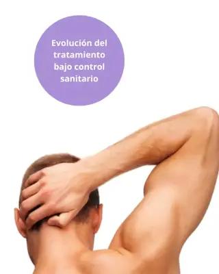 Axila masculina como referencia al tratamiento de depilación láser.